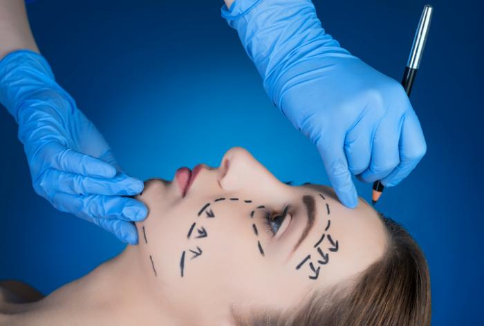 How to Choose the Right Surgeon for Neck Lift Surgery?